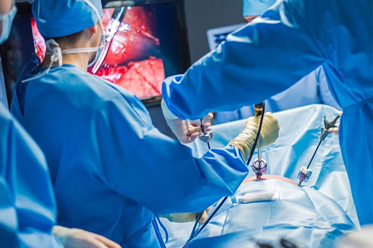 Laparoscopic Abdominal Surgeries